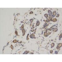 Bcl-2 Monoclonal Antibody