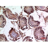 NTE Polyclonal Antibody