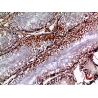 NTE Polyclonal Antibody