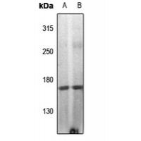 DAPK1 (Phospho-Ser308) Antibody