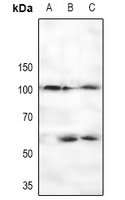 CTIP (Phospho-Ser327) Antibody