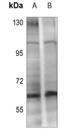 Chk2 (Phospho-Thr432) Antibody