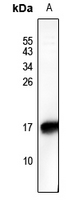 HMG17 (Phospho-Ser29) Antibody