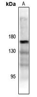 ASK1 (Phospho-Thr838) Antibody