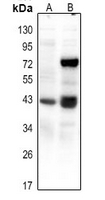 CREB (Phospho-Ser111) Antibody