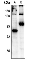 FKHRL1 (Phospho-Ser315) Antibody