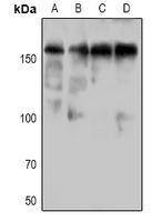 DAPK1 (Phospho-Ser736) Antibody