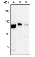 EPHA8 (Phospho-Tyr838) Antibody