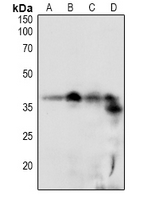 DSCR1 (Phospho-Ser108) Antibody