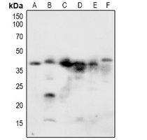 NACA (Phospho-Ser43) Antibody