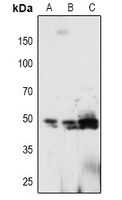 PTP1B (Phospho-Tyr66) Antibody