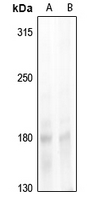 SRC-1 (Phospho-Thr1179) Antibody