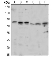 TAB1 (Phospho-Ser438) Antibody