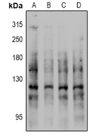 CDH1 (Phospho-Ser844) Antibody