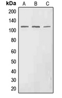 EPHA3 (Phospho-Tyr602) Antibody