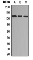 EPHA7 (Phospho-Tyr608) Antibody