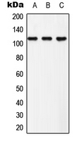 EPHB3 (Phospho-Tyr608) Antibody