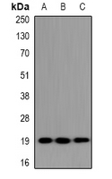 UBE2G1 Antibody