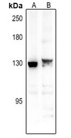 NEB2 Antibody - SAB | Signalway Antibody