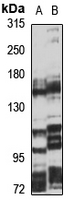 NPC1L1 Antibody