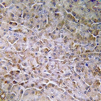 SEMA3C Antibody