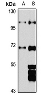 ZBTB17 Antibody