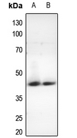 CCRN4L Antibody