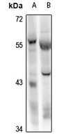 RBPJL Antibody