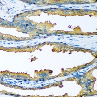 Cytochrome P450 46A1 Antibody