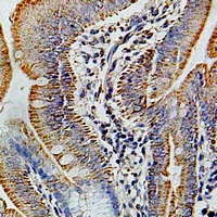 Cytochrome c Oxidase 6B1 Antibody