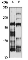 LRP4 Antibody