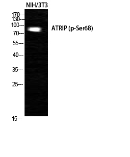 ATRIP (Phospho-Ser68) Antibody