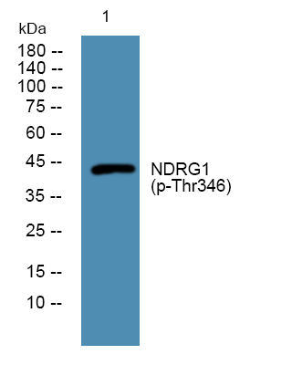 NDRG1 (Phospho-Thr346) Antibody