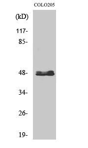 Cytochrome P450 11B2 Antibody