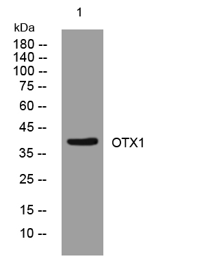 Otx1 Antibody