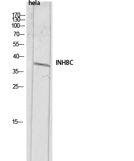 Inhibin β-C Antibody