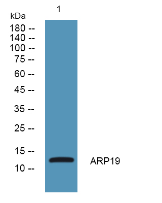 ARPP19 Antibody