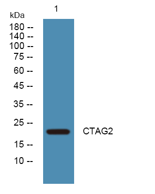 CTAG2 Antibody