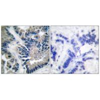 Stat2 Polyclonal Antibody