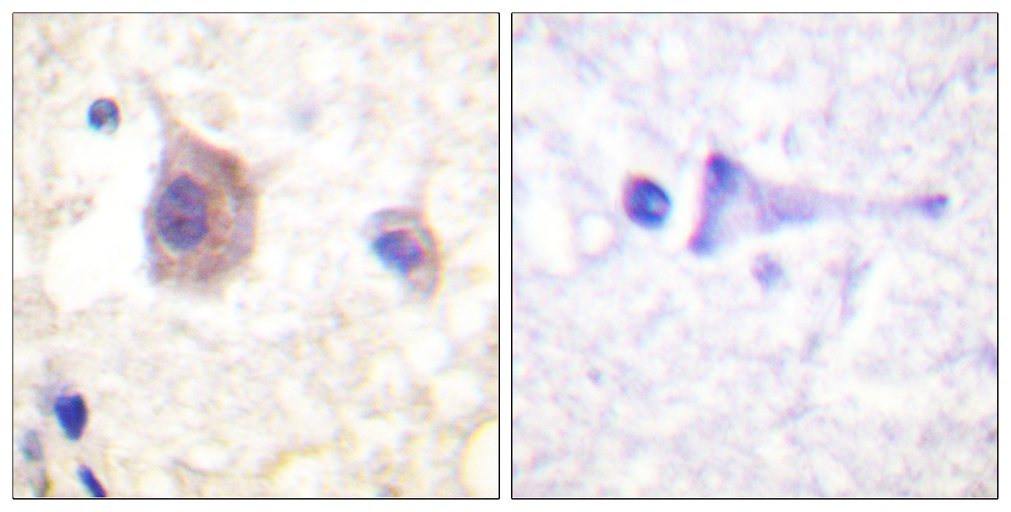 PKD1/PKC μ (Phospho-Tyr463) Antibody