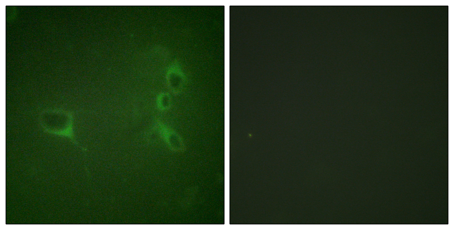 Bcr (Phospho-Tyr360) Antibody