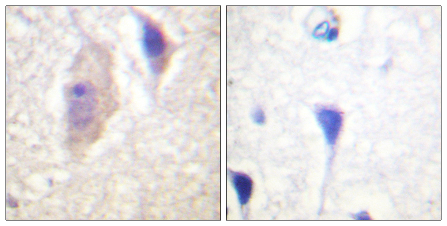 Bcr (Phospho-Tyr360) Antibody