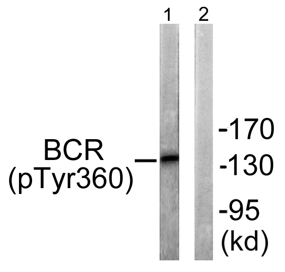 Bcr (Phospho-Tyr360) Antibody