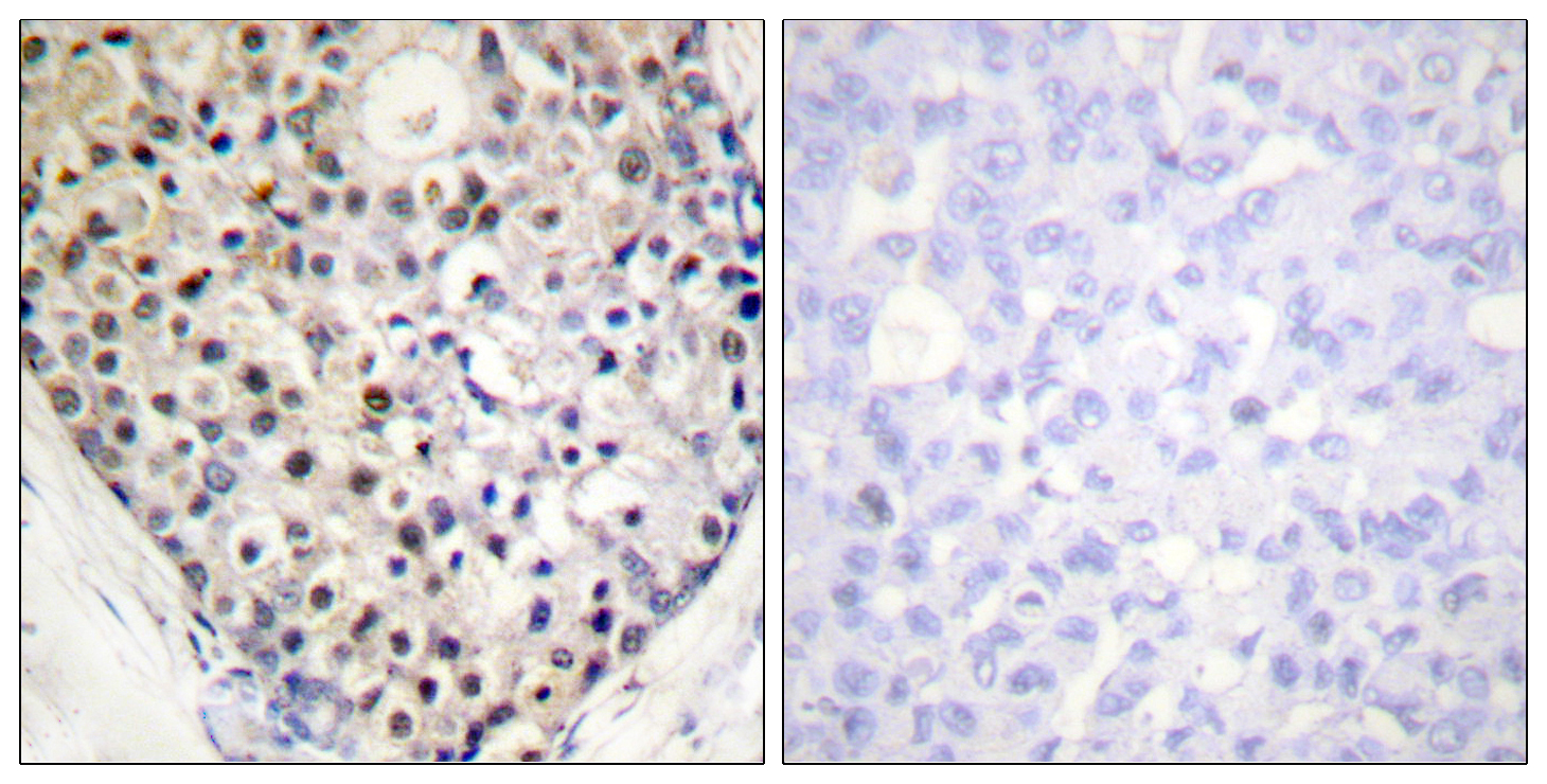 CHOP (Phospho-Ser30) Antibody