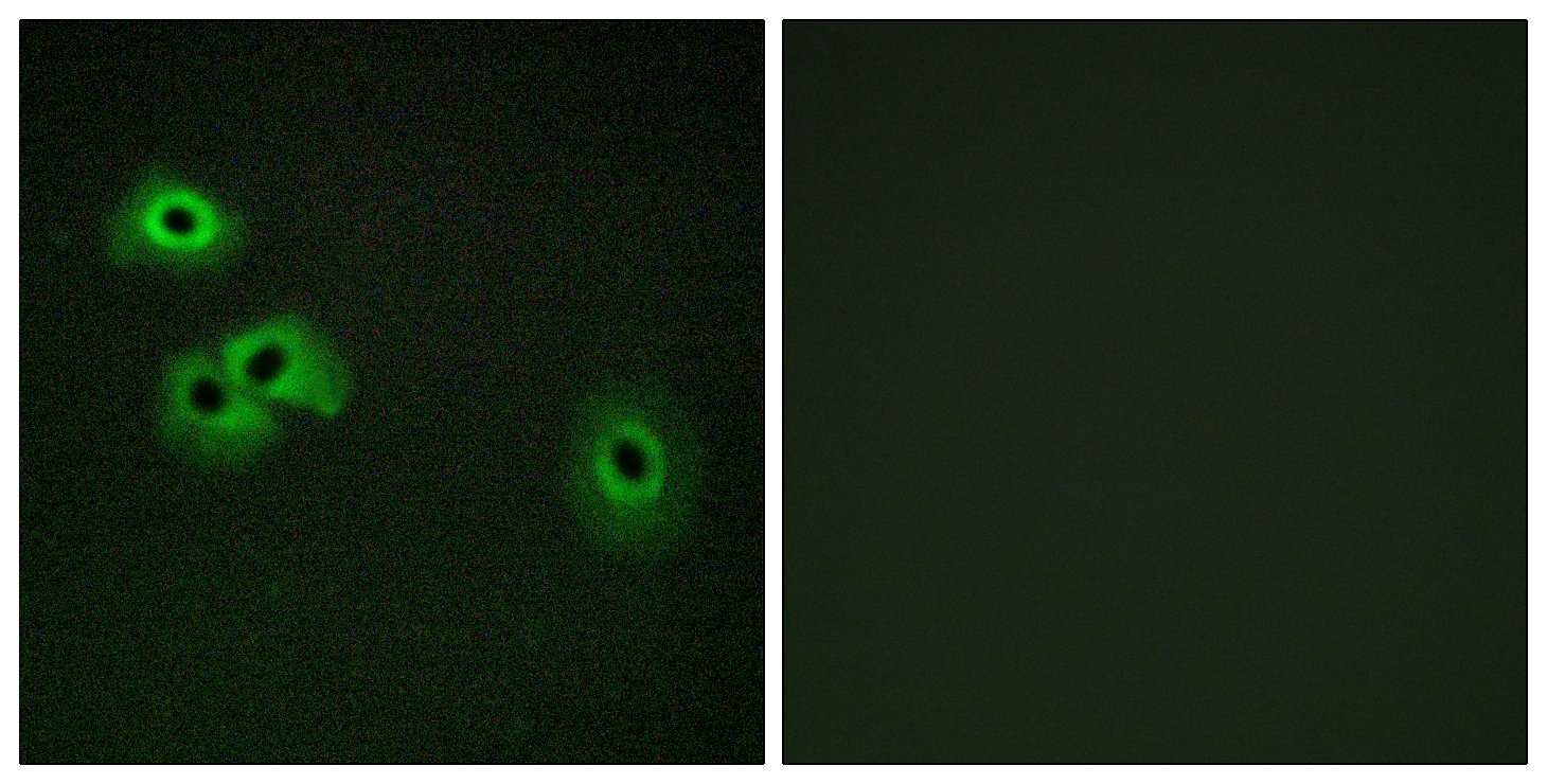 Calmodulin (Phospho-Thr79/Ser81) Antibody