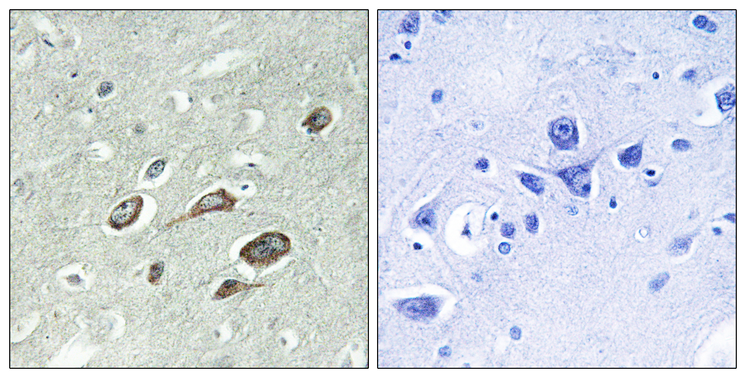 Calmodulin (Phospho-Thr79/Ser81) Antibody