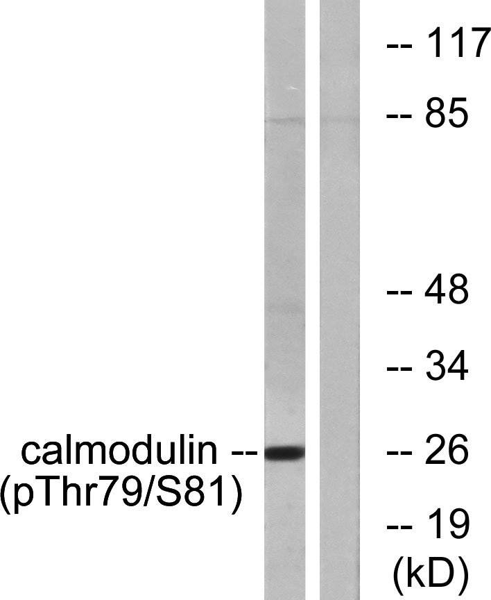 Calmodulin (Phospho-Thr79/Ser81) Antibody