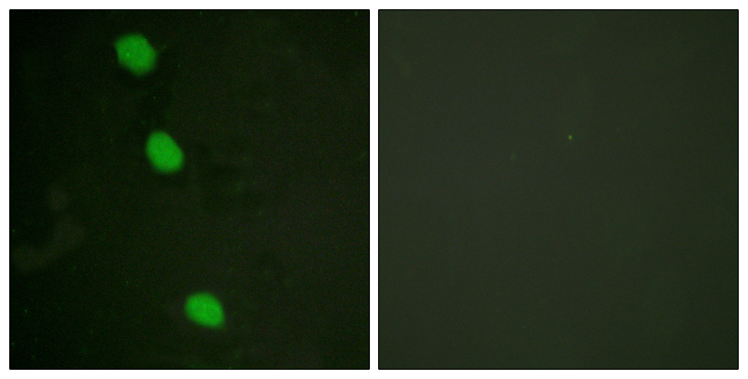 CaMK4 (Phospho-Thr196/200) Antibody