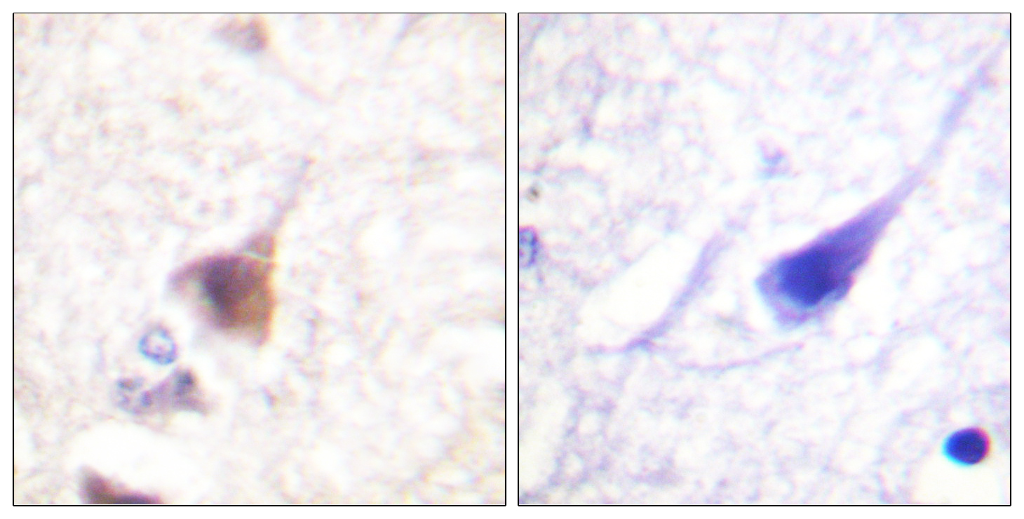 CaMK4 (Phospho-Thr196/200) Antibody