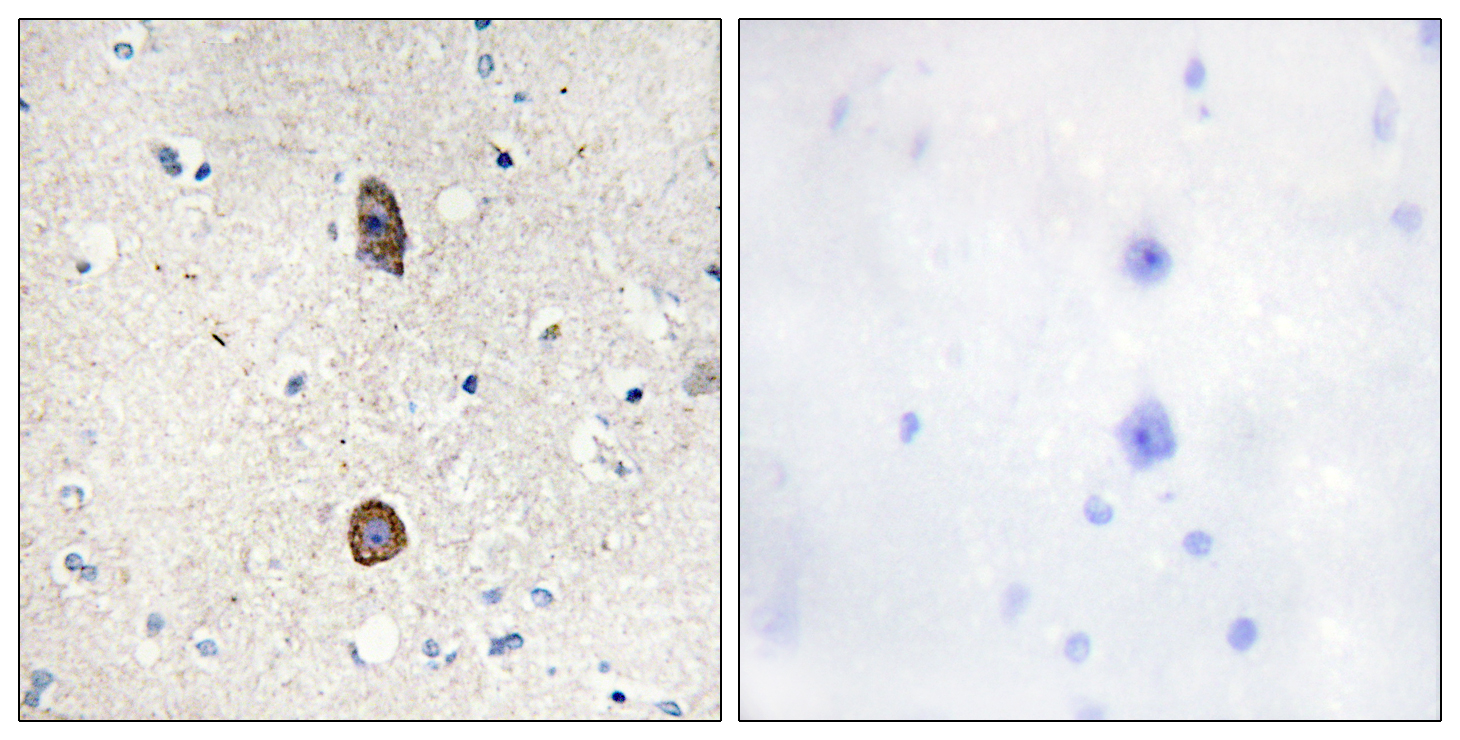 IGFBP-3 (Phospho-Ser183) Antibody